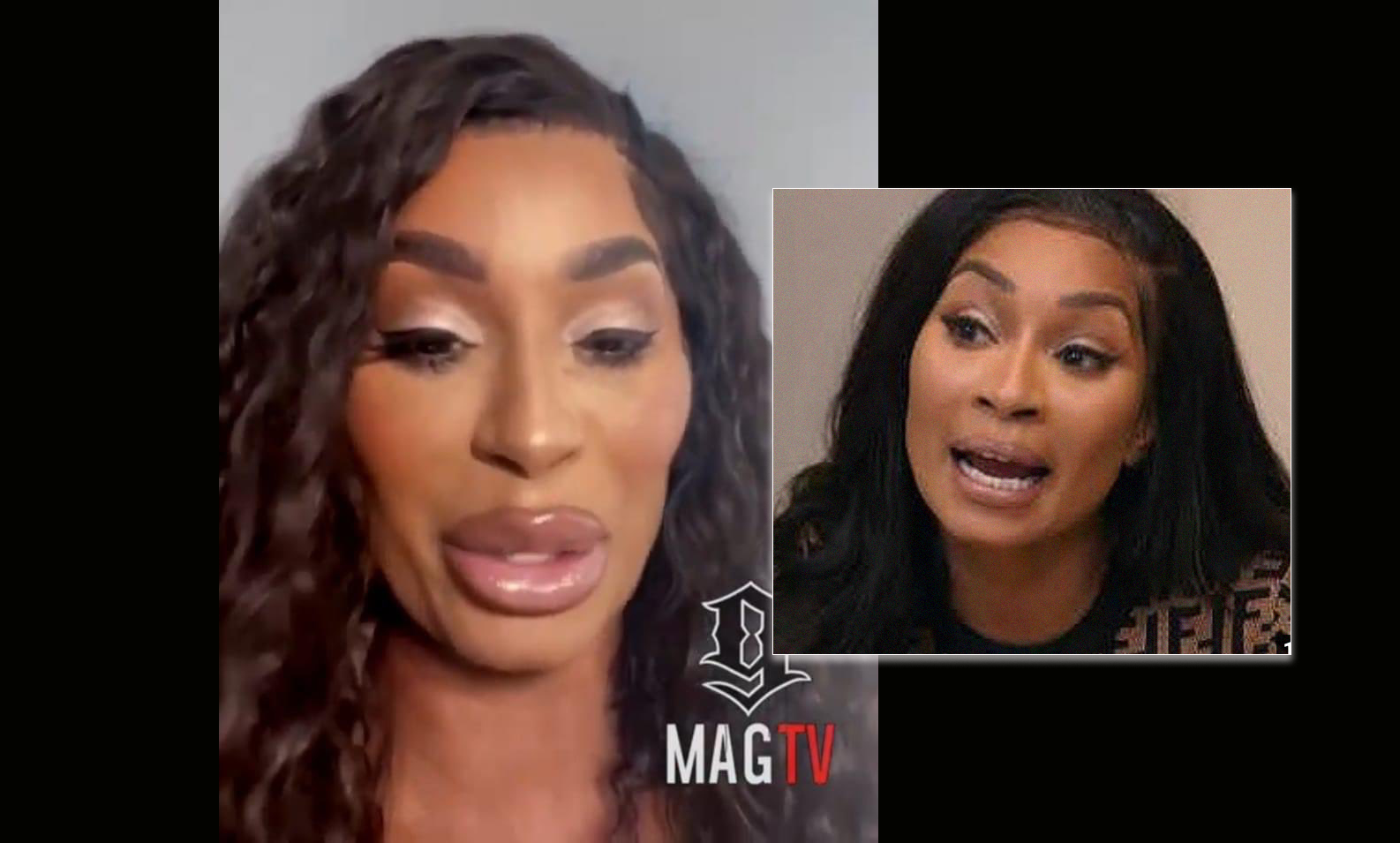 Love And Hiphop Karli Redd Goes Viral After She Unveils Her Newly Botched Face Wtf