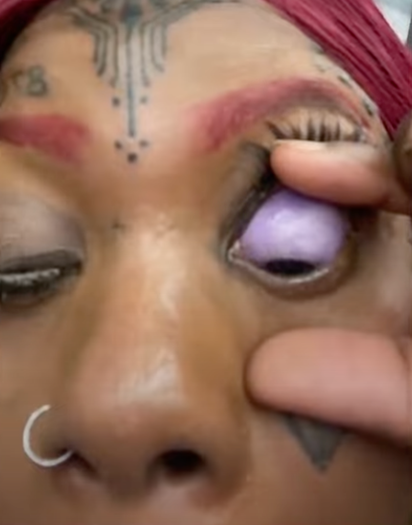 Irish' Black Woman Who Tattooed Her EYES Blue And Purple ... Is Now Going  Blind!! (Pics & Details) - Media Take Out