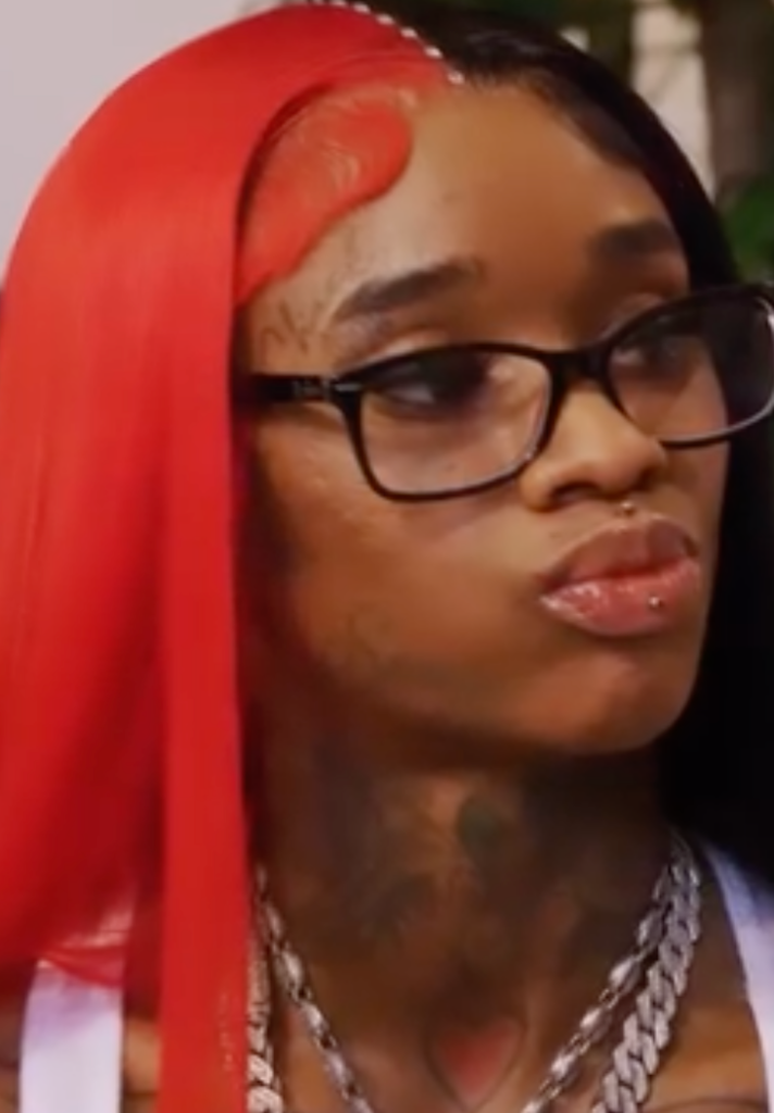 Uh Oh Female Rapper Sexyy Red Seen W Mystery Sore On Her Top Lip Wrapva