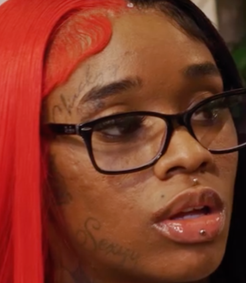 Uh Oh Female Rapper Sexyy Red Seen W Mystery Sore On Her Top Lip